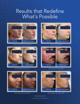 AviClear product brochure-3