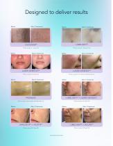 Xeo+ product brochure-5