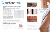 ClearScan YAG-2