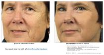 Resurfacing Leave-behind-2