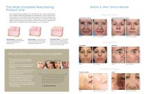 Resurfacing Product Brochure-2
