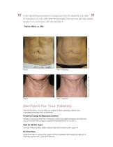 SkinTyte-3