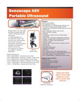 Sonoscape A6V Ultrasound - 2