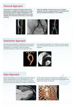 3mensio Aortic Root-4