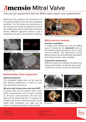 3mensio Mitral valve