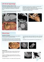 3mensio Structural heart-3