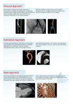 3mensio Structural heart-4