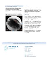 Left Atrial Appendage white paper-4