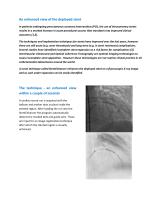 StentEnhancer-2
