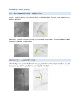 StentEnhancer-3