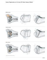 2.4mm LCP® Volar Column Distal Radius Plates - 3