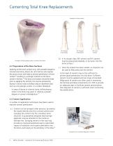 Cementing Total Knee Replacements - 4