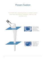 CORAIL® Hip System Design Rationale - 4