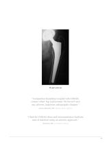 CORAIL® Hip System Design Rationale - 9