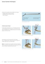 Distal Radius - 10