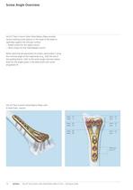 Distal Radius - 12