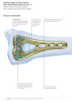 Distal Radius - 4