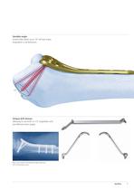 Distal Radius - 5