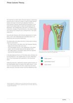 Distal Radius - 9