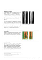 Expert Tibial Nail PROtect: The first antibiotic-coated tibial nail - 11