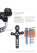 LCP Percutaneous Aiming System 3.5 for PHILOS. - 5