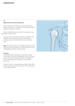 LCP Percutaneous Aiming System 3.5 for PHILOS. - 8