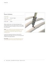 MatrixRIB®FixationSystem - 14