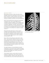 MatrixRIB®FixationSystem - 4