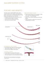 MatrixRIB®FixationSystem - 9