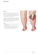 Olecranon - 8