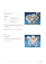 Sacral Bars - 11