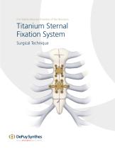 Titanium Sternal Fixation System