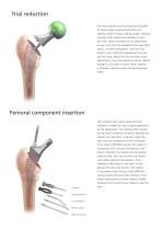 TRI-LOCK® Product Rationale - 8