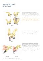 TruMatch Pin Guides - 4