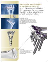 VA LCP ® Distal Radius System - 4