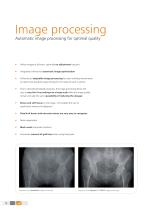 Digital radiography with the Amadeo S-DR U-arm system for X-ray imaging without cassettes - 8