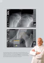 Digital X-ray in the modern medical practice - 15