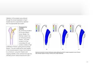 MiniHip - design rationale - 7