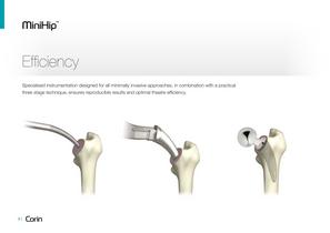 MiniHip - product overview-8