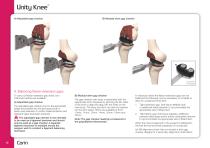 Unity knee surgical technique - 12