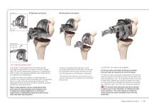 Unity knee surgical technique - 13