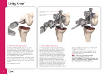 Unity knee surgical technique - 8