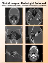 OTOscan-5