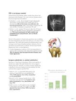 why bicompartmental A REVOLUTIONARY ALTERNATIVE TO TOTAL KNEE REPLACEMENTS-3