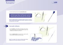 Easyspine®-4