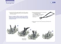 Easyspine®-8