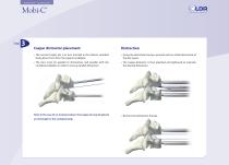 Mobi-C® Plug & Fit-4