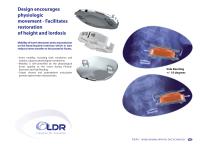 MOBILE BEARING ARTIFICIAL DISC TECHNOLOGY-5