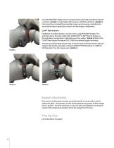 BIOFOAM Wedge System SURGICAL TECHNIQUE - 8