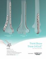 EVOLVE Elbow Plating System (EPS) - 1